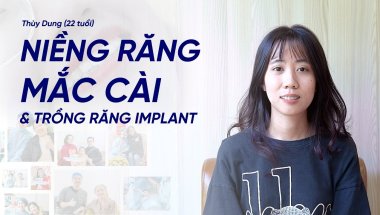 Thùy Dung (22 tuổi) – Hành trình chạm tới nụ cười mơ ước cùng niềng răng mắc cài