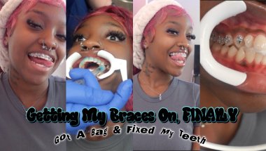 Getting Braces for the First Time 😭 | Come With Me to the Ortho! | Beauteous Benita