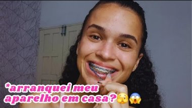 DESTRUINDO MEU APARELHO EM CASA |*arranquei meu aparelho em casa?🫣😱
