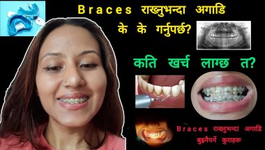 "Before Braces: Cost & Truth Revealed" 😱 What You MUST Know Before Getting Braces"/My braces journey