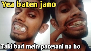Braces Lagane Se Pehle Zaroor Jaan Lo! | Braces Tips in Hindi