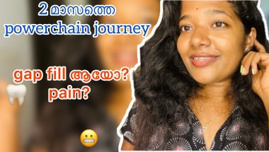 എന്റെ പല്ലിലെ 🦷power chain remove ചെയ്തു ✅🤓|power chain removed |Malluz express