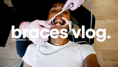 GOT A BAG 💰 AND FIXED MY TEETH | RAW VLOG