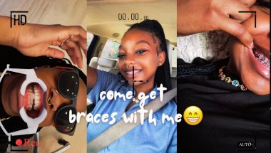 come with me to get my braces 😅😁