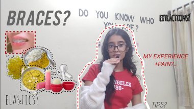 Everything I Wish I Knew Before Getting Braces!