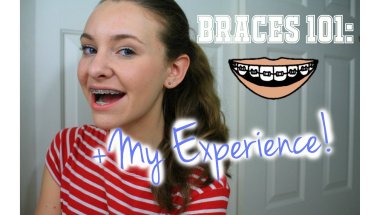 Braces 101: My Experience With Braces