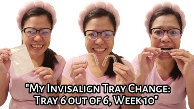 My Invisalign Tray Change: Tray 6 out of 6 | Week 10 | Experience | Tagalog