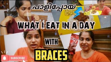 🦷പല്ലിൽ കമ്പി ഇട്ട് എന്തൊക്കെ തിന്നാം😁/What i eat in a day with Braces  #whatieatinaday #familyvlog