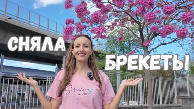 Сняла брекеты в Израиле! Результат, цены и что дальше