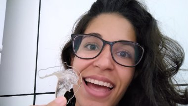 MEU APARELHO ORTODÔNTICO MÓVEL