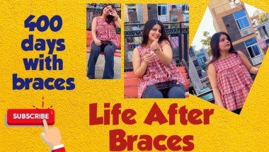 Life after braces 😬 #youtube #dentist #viral #teeth #trending #teeth #toptrending #viralvideo