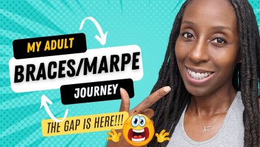 THE GAP IS HERE!!