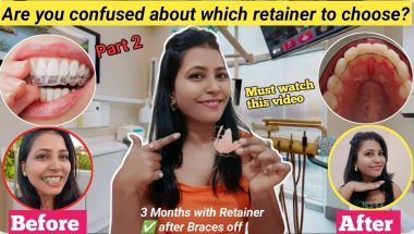 🦷My Braces Journey ll 2 years Braces Experience 😍 / Which Retainer is Right for You? Retainers Time?