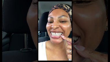 Getting My Teeth Cleaned With Braces | 😬 #braces #dentist #over40