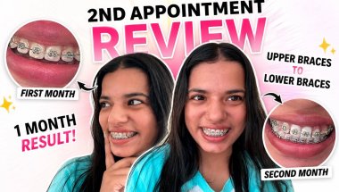 My First Month With Braces 😬 | Pain, Changes & Honest Review | Braces Journey Update