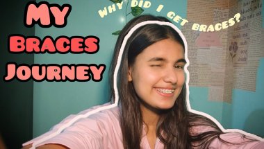 My braces journey✨ | Everything that happened 🥹😭