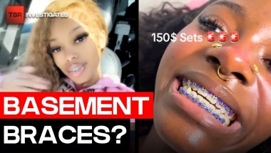“Basement Braces” Are Going Viral And Dentists Are Concerned | TSR Investigates