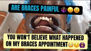 HERE’S WHAT REALLY HAPPENED ON MY BRACES APPOINTMENT:BRACES INSTALLATION😳🤷🏾‍♀️ 10K views 24 hour ago