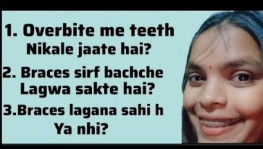 Braces se judi kuchh baatein🦷 || fear of getting braces || #bracesjourney #smiletransformation