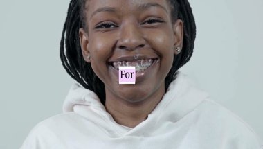 Why I Chose "Damon Braces" Over "Invisalign": 4 Extractions Journey | strawberry ♡
