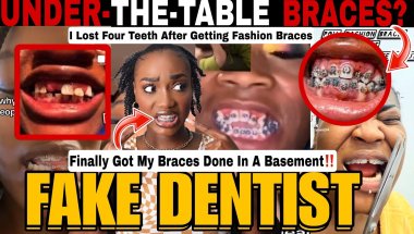 BASEMENT BRACES EXPOSED! The Dangerous Fake Braces Trend Taking Over Social Media + Fashion Braces
