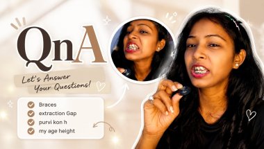 😲QnA Honest Answering || Braces Painful or Not YouTube Setup tools 😍✨🪷Miss Archu vlogs