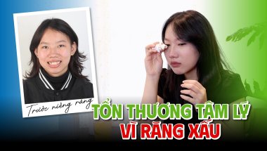 Niềng Răng - Để Không Ai Có Thể Lấy Nụ Cười Ra Làm Tổn Thương Mình
