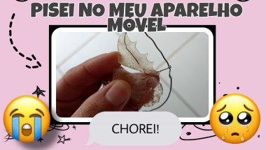 FIQUEI SEM USAR O APARELHO MÓVEL, SERÁ QUE O DENTE ENTORTOU?