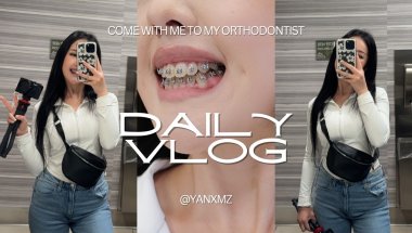 Braces Vlog Ep. 16: A LONG WAITED BRACES VLOG!!! Updates + powerchain + new wires