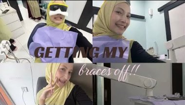 FINALLY BRACES OFF😫😫🦷🦷