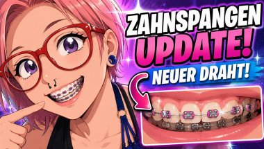 Drahteselupdate | Der neue Draht kam rein 🙃 #zahnspange #kieferorthopädie