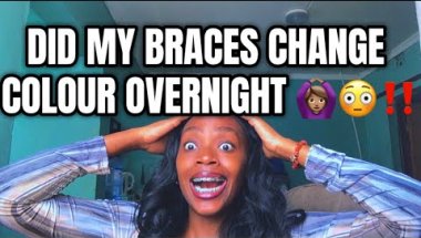 MY BRACES CHANGED COLOUR OVERNIGHT…WHAT HAPPENED??? 10K views 24 hours ago