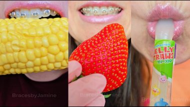 ASMR Satisfying eating MR.Beast FEASTABLES CHOCOLATE🍫 Food vs Braces #asmr #braces #dentist #mrbeast