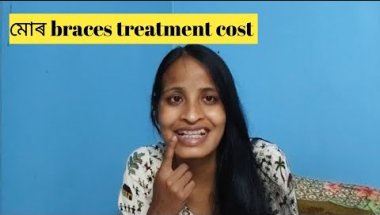 Day-11/200 challenge/ মোৰ braces treatment cost ?