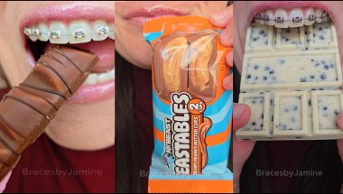 Mr. Beast Bars vs Braces  ASMR Food #asmr #braces #dentist #mrbeast