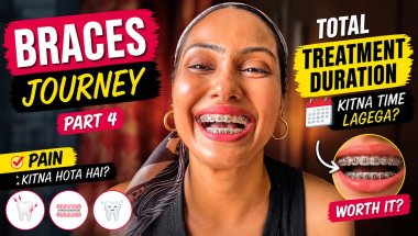 Braces Journey Part 4 | Pain Level 😭 + TotalTreatment Duration ⏳