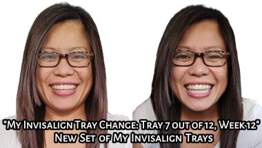 My Invisalign Tray Change: Tray 7 out of 12 Week 12 | Experience | New Sets of Trays | Tagalog