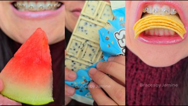 Mr. Beast Bars vs Braces  ASMR Food #asmr #braces #dentist #mrbeast