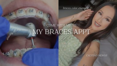 Braces Vlog Ep.17: EXCITING NEWS!!! getting braces off!? + I got married💍🤍