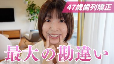 【47歳歯列矯正】終わりが見えてきた今、伝えたいこと。最大の勘違いとは？
