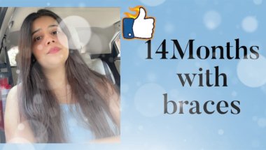 14Months with braces My teeth transformation #shorts #youtube #viral #beforeandafter #braces #viral