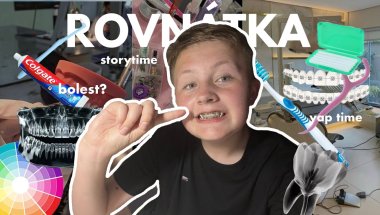 ROVNÁTKA - bolí to?, gumičky, nasazování…..| maaatyas