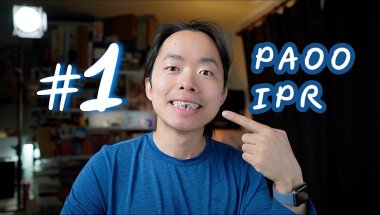 Braces Journey #1: I Pulled a Front Tooth for Braces | PAOO | IPR #braces #dentalvlog #PAOO