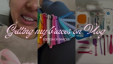 Getting my braces on VLOG!!! 😝🤍 *excited*