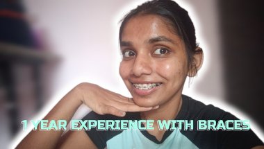 One year experience with braces |Braces journey| Braces experience