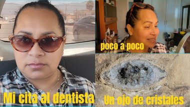 No soy importante para quien es importante para mi... un ojo de cristal, mi dentista la mejor!