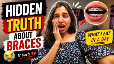 Hidden Braces Journey Day 1: Pain, Struggle & Mom’s Love ❤️