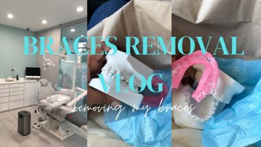 vlog 💌 : I FINALLY REMOVE MY BRACES | *AFTER 7 YEARS!*