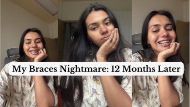 What Braces Did To Me (Not What I Expected)