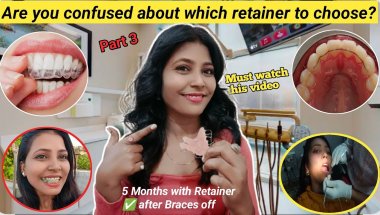 🦷My Braces Journey ll 2 years Braces Experience 😍 / Which Retainer is Right for You? Retainers Time?